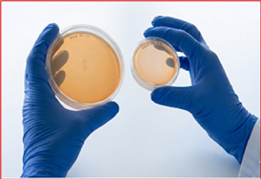 Agar Media Plates ( 90 mm & 55 mm)
